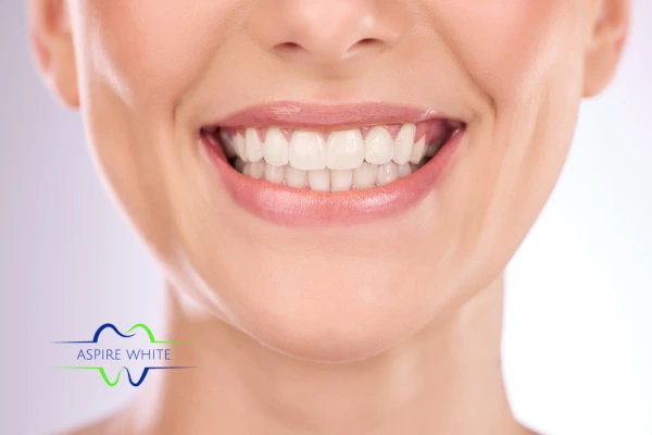 Follow your teeth whitening aftercare Northampton to prolong your whiter smile!